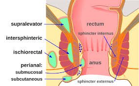 Anal Abscess Treatment